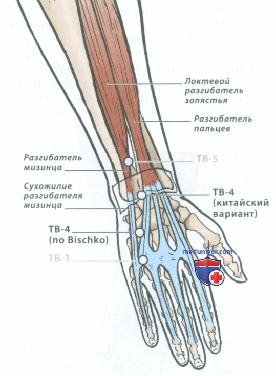 Точка тройного обогревателя 4 ян чи в акупунктуре