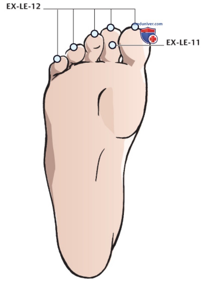 ����� EX-LE-11 �� ��� � EX-LE-12 �� ����� � �����������