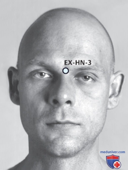 ����� EX-HN-3 ��� ��� � �����������