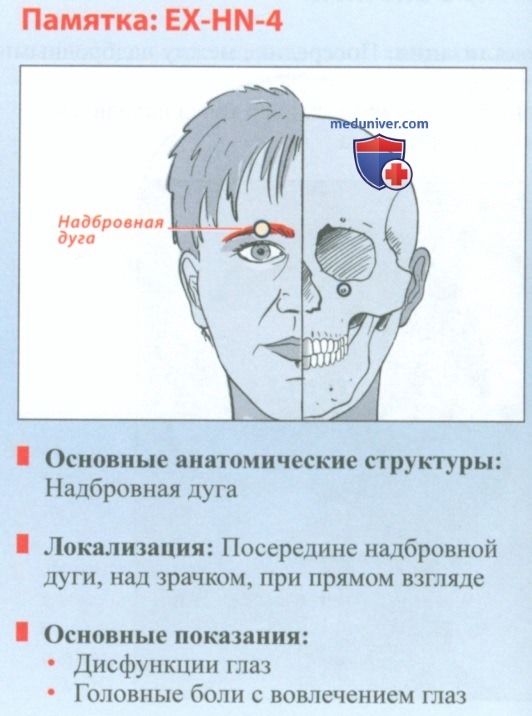 ����� EX-HN-4 �� �� � �����������