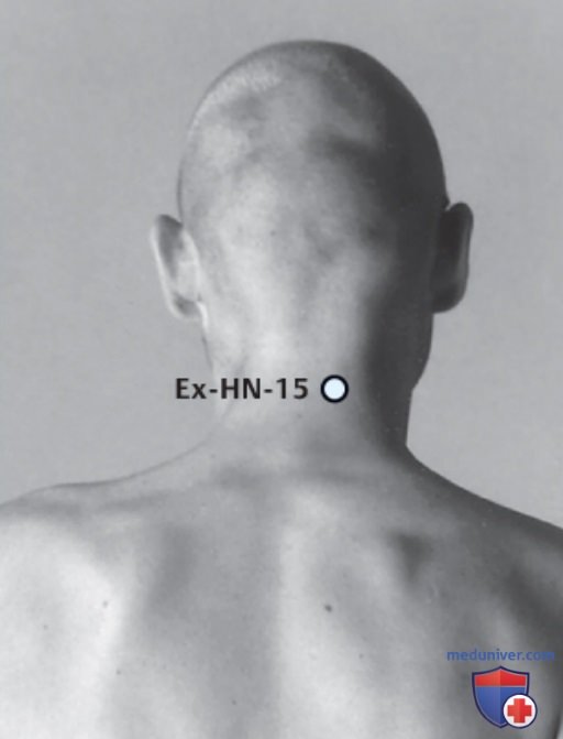 ����� EX-HN-15 ���� ��� ��� � �����������