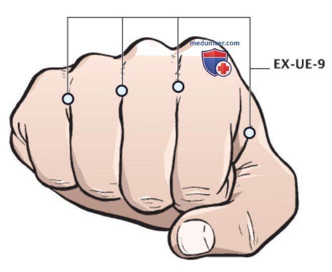Точка EX-UE-9 ба сиэ в акупунктуре