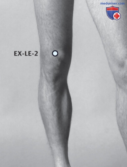����� EX-LE-2 �� ��� � �����������