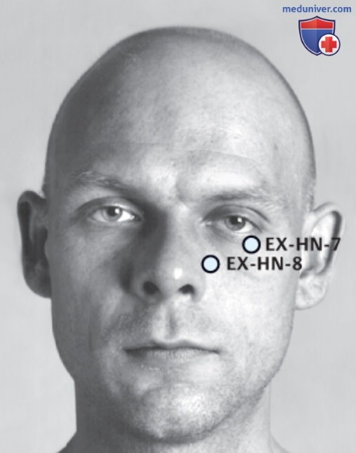 ����� EX-HN-7 �� ���, EX-HN-8 ��� �� ��� ��� �� ��� � EX-HN-9 ��� �� ��� � �����������