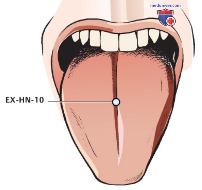 ����� EX-HN-10 ���� �����, EX-HN-11 ��� �����, EX-HN-12 ����� ����� � EX-HN-13 � � � �����������