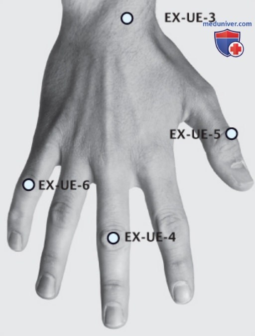 ����� EX-UE-3 ���� �����, EX-UE-4 ���� ���, EX-UE-5 �� �� ���, EX-UE-6 ��� �� ��� � �����������