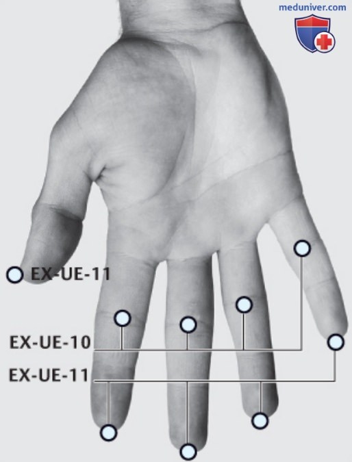 ����� EX-UE-10 �� ��� � EX-UE-11 �� ����� � �����������