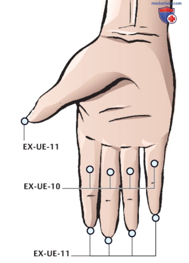 ����� EX-UE-10 �� ��� � EX-UE-11 �� ����� � �����������