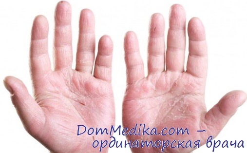 Перчатки при заболевании кожи рук thumbnail