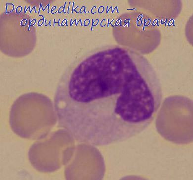 Мазок крови анемии лейкозы thumbnail
