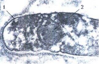   (Mycobacterium leprae):    