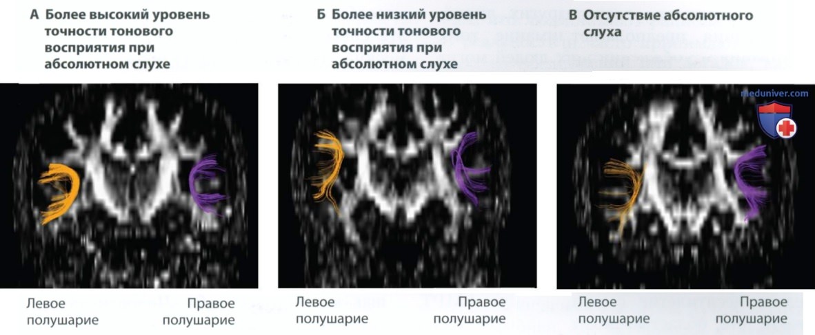 Познание и ассоциативная кора