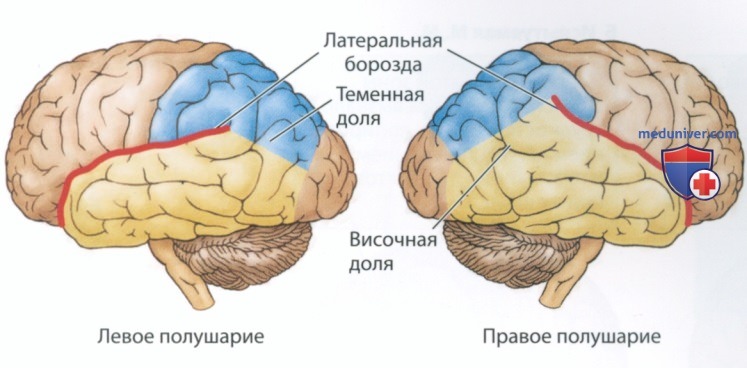 Структурная асимметрия головного мозга