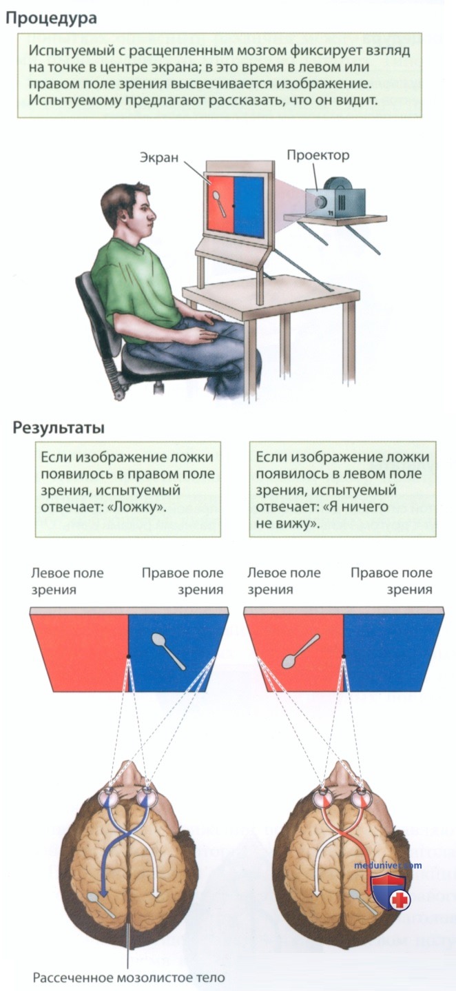 Функциональная асимметрия здорового мозга
