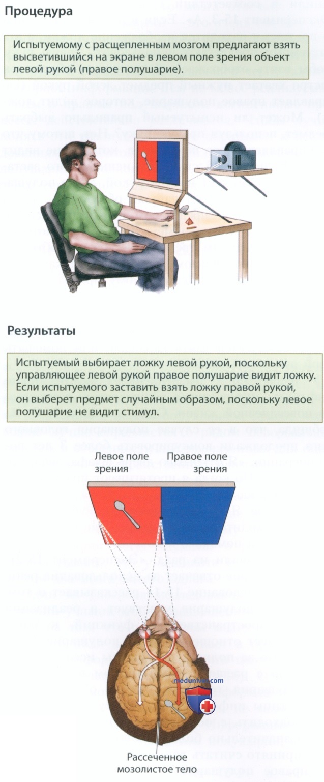 Функциональная асимметрия здорового мозга