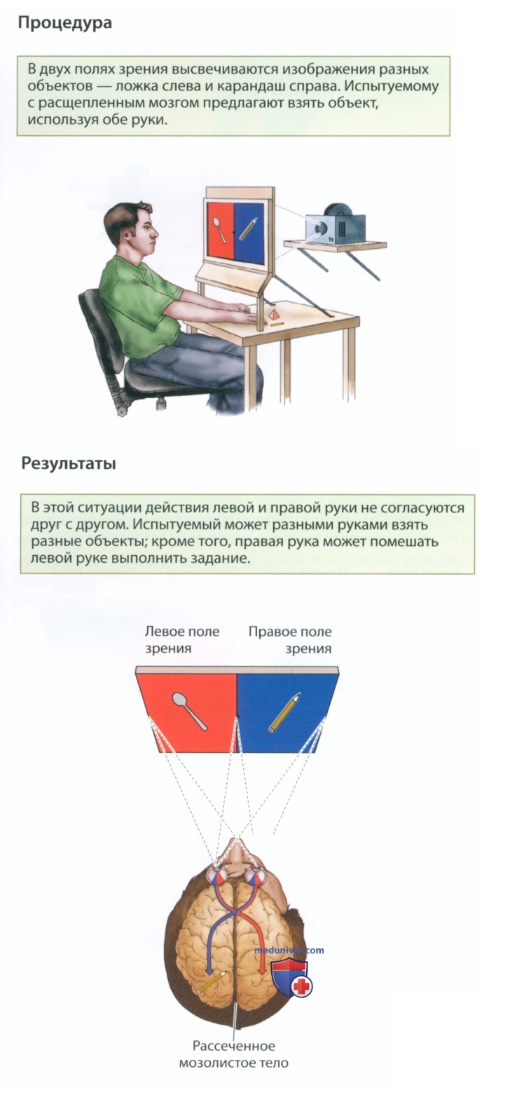 Функциональная асимметрия здорового мозга