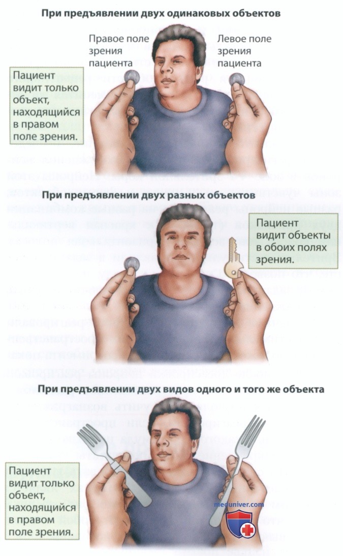 Познание и ассоциативная кора