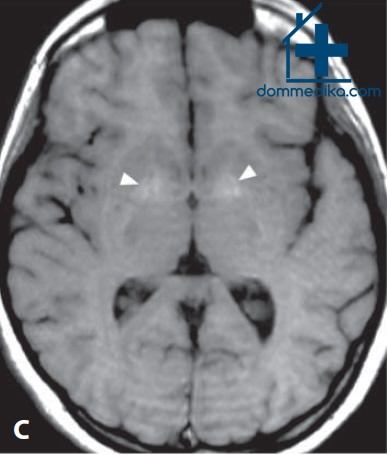 ��� ��������� ����� ��� ������������ ������ �������� (���������� ������� �����)