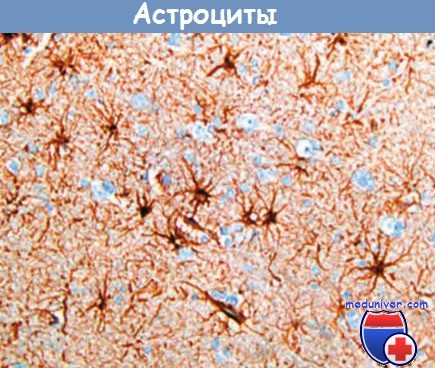 Астроцит клиника. Астроцитная глия. Глиальный фибриллярный кислый белок окрашивание. Астроциты и клетки швана это 1 и то же.