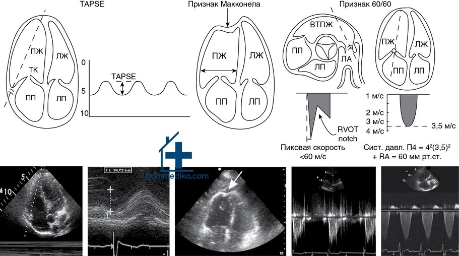 ������������ ������ (H) �� ��������� ����, ���������� � ��������